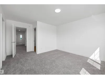 8632 183 AV NW photo 32