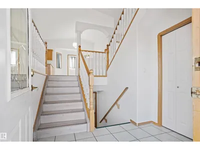 2915 151A AV NW photo 9