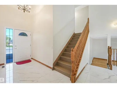 18623 70 AV NW photo 6