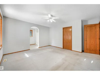 16206 84 ST NW photo 28