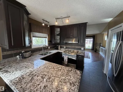 5304 155 AV NW photo 11
