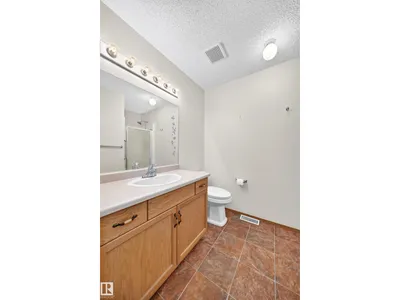 6526 158 AV NW photo 38
