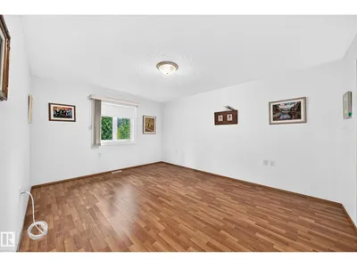 6526 158 AV NW photo 31