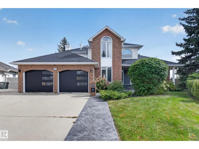 35 Ridgemont WY, Sherwood Park